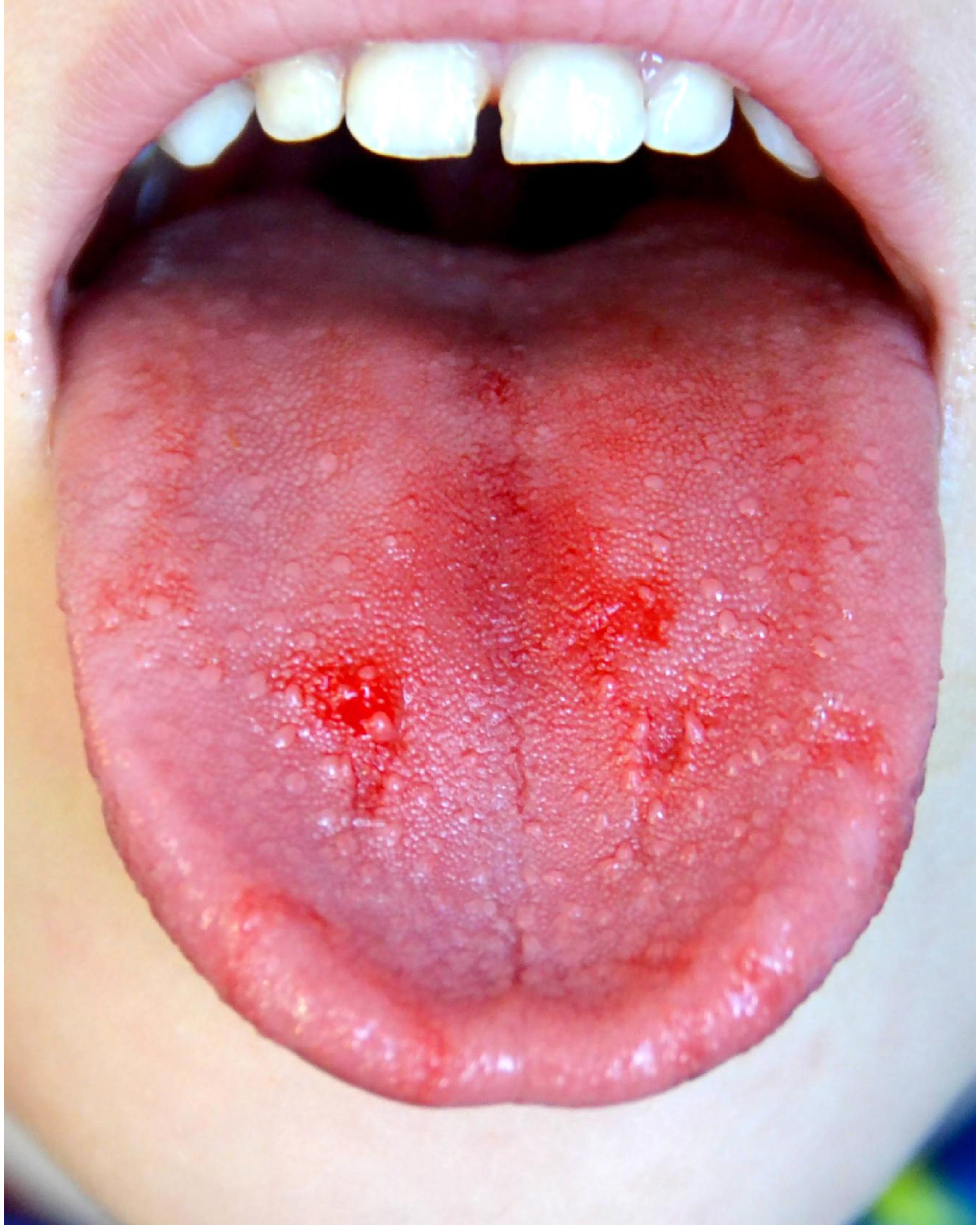 benefits of lavangadi vati